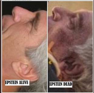 Image result for epstein ears